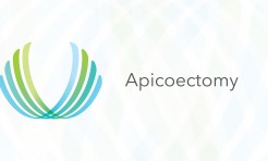 Apicoectomy performed by Dr. Zachary C. Weber, DMD, MD