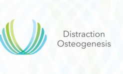 Distraction Osteogenesis performed by Dr. Zachary C. Weber, DMD, MD