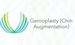 Genioplasty (Chin Augmentation) performed by Dr. Zachary C. Weber, DMD, MD